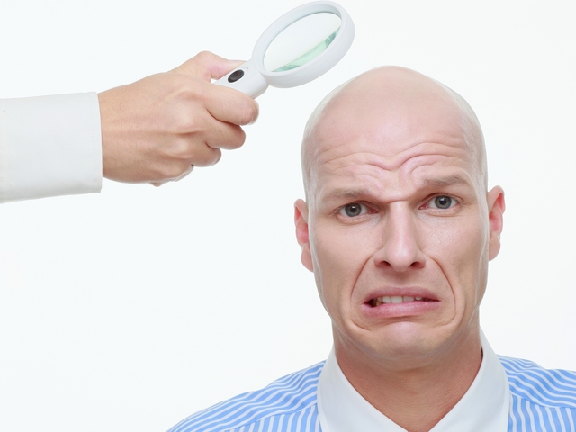 Men’s Hair Loss – How to Reduce Hair Loss in Men